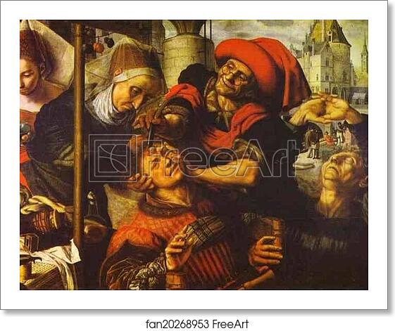 Free art print of The Surgeon by Jan Sanders Van Hemessen Free art print of The Surgeon by Jan Sanders Van Hemessen
